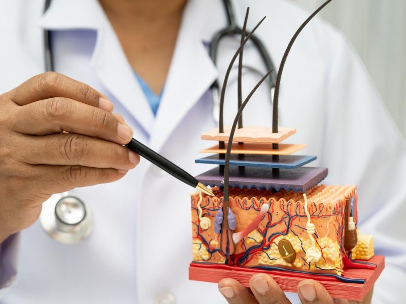 doctor pointing to the skin structure model