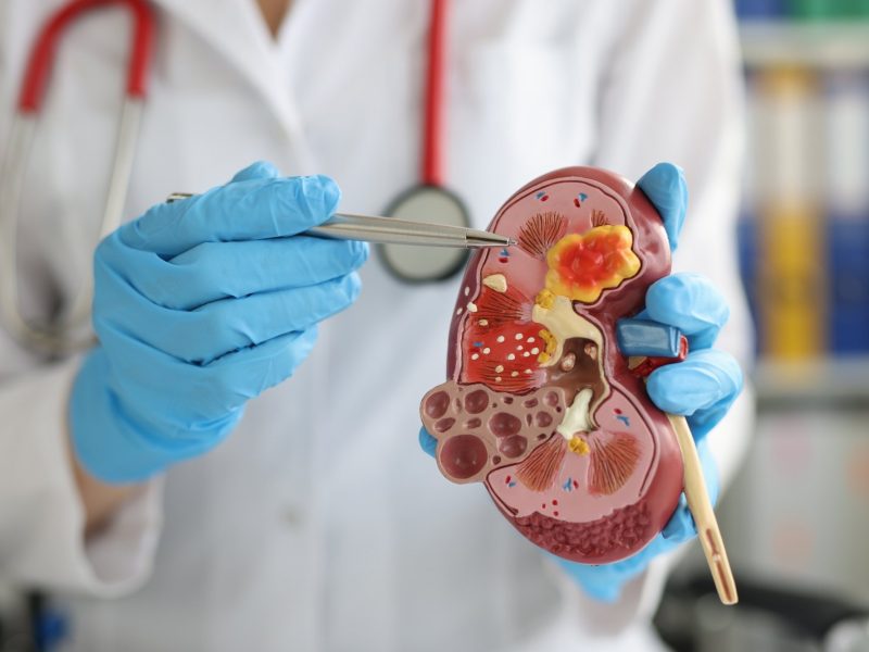 urologist explaining urinary system
